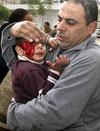 niño herido